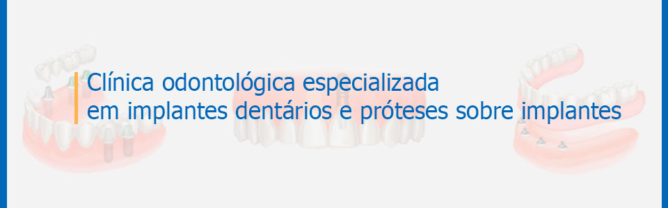 Clínica especializada em implantes e próteses sobre implantes